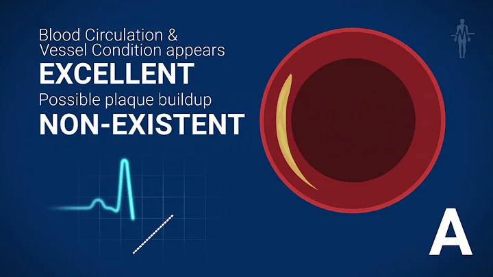 Blocked Arteries - Test for Arterial Stiffness with Screening Analyzer