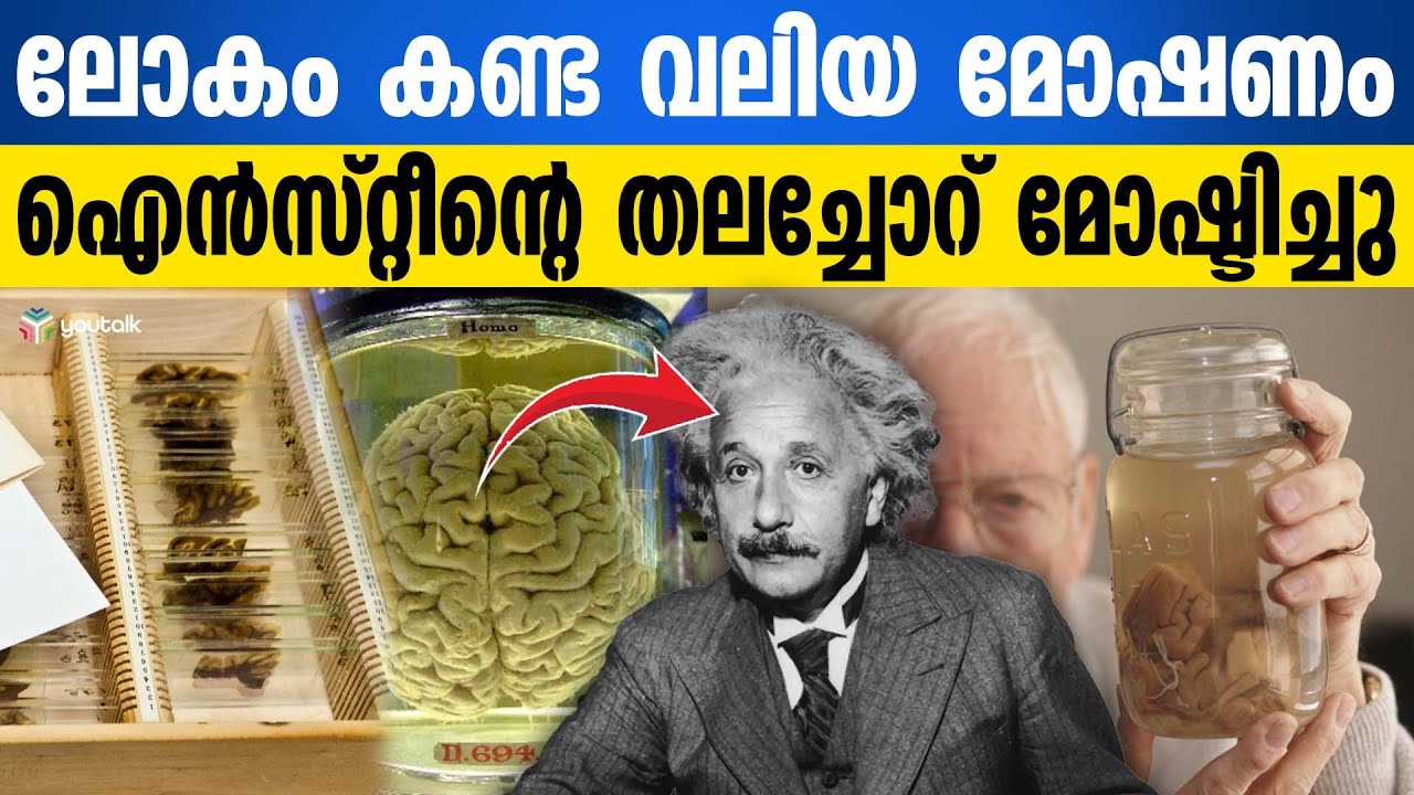 ഐൻസ്റ്റീന്റെ തലച്ചോറ് മോഷണം പോയ ദുരൂഹകഥ | The Secret of Einstein's ...