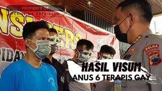 Kembangkan Kasus Pijat Gay di Solo, Begini Hasil Visum 6 Terapis di Bagian 'Saluran Pembuangan'