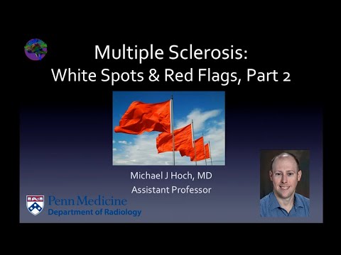 Multiple sclerosis – white spots and red flags - part 2 - Mimics and Variants