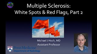 Multiple sclerosis – white spots and red flags  part 2  Mimics and Variants