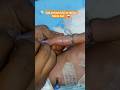 #Successful IV Cannula Insertion Every Time 💯 | Easy Tips &amp; Tricks #shorts #medicalshorts.#aaj sin..