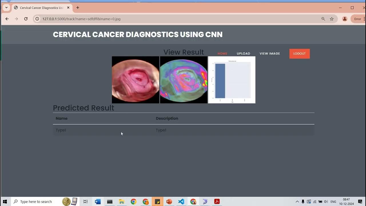 Cervical Cancer Detection Using Deep Learning - YouTube