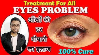 Cure For all eye Problems | Improve your eyesight & get rid of Spectacles आँखों की हर बीमारी का इलाज