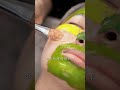 This young lady's hesperidin "family bucket"—who wouldn't love such fair and clear skin!