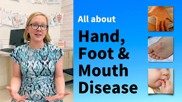 All about Hand, Foot, and Mouth Disease in children and adults