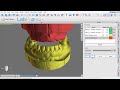 Digital Denture Tutorial in Blue Sky Plan V 4.5.9