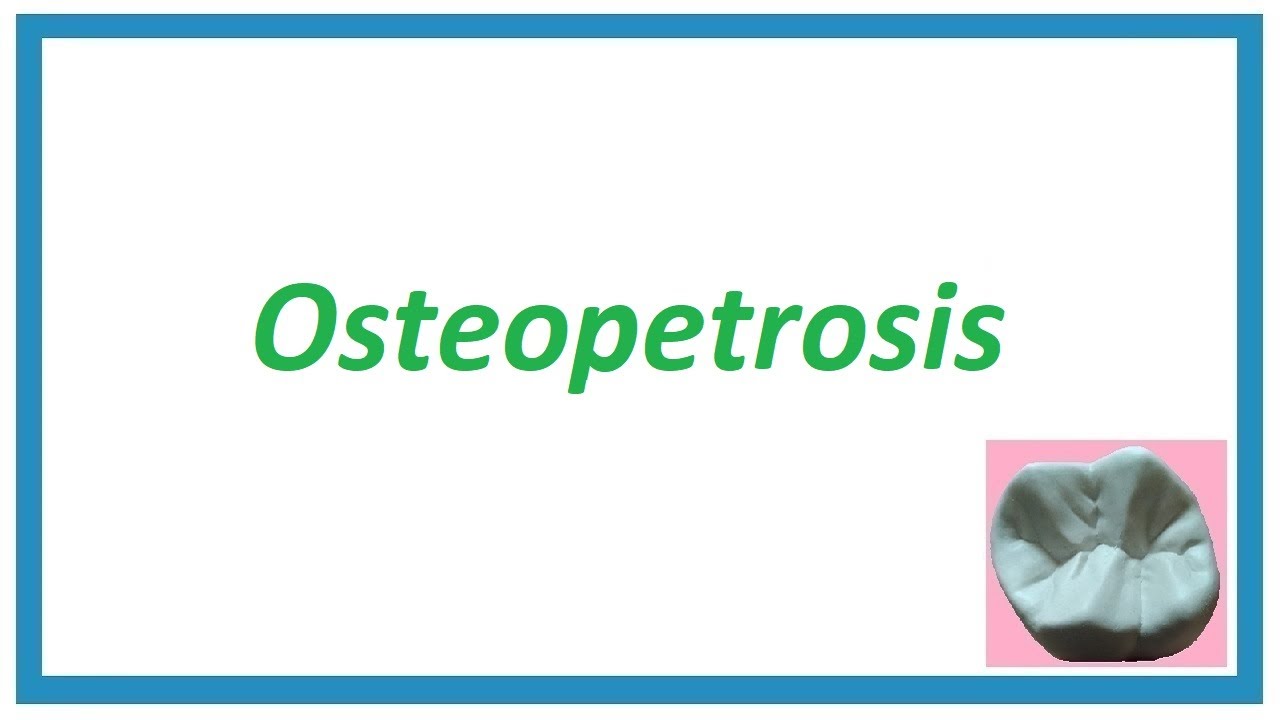 Osteopetrosis/Marble bone disease Important Notes Diseases of Bone