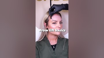 Brow Lift Basics #botox #browlifting