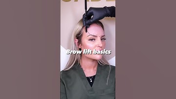 Brow Lift Basics #botox #browlifting