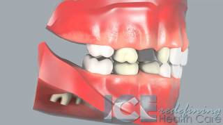 Dental Development (Lateral View)