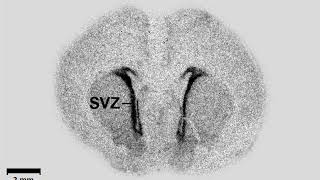 Radioactivity in the life sciences | Wikipedia audio article