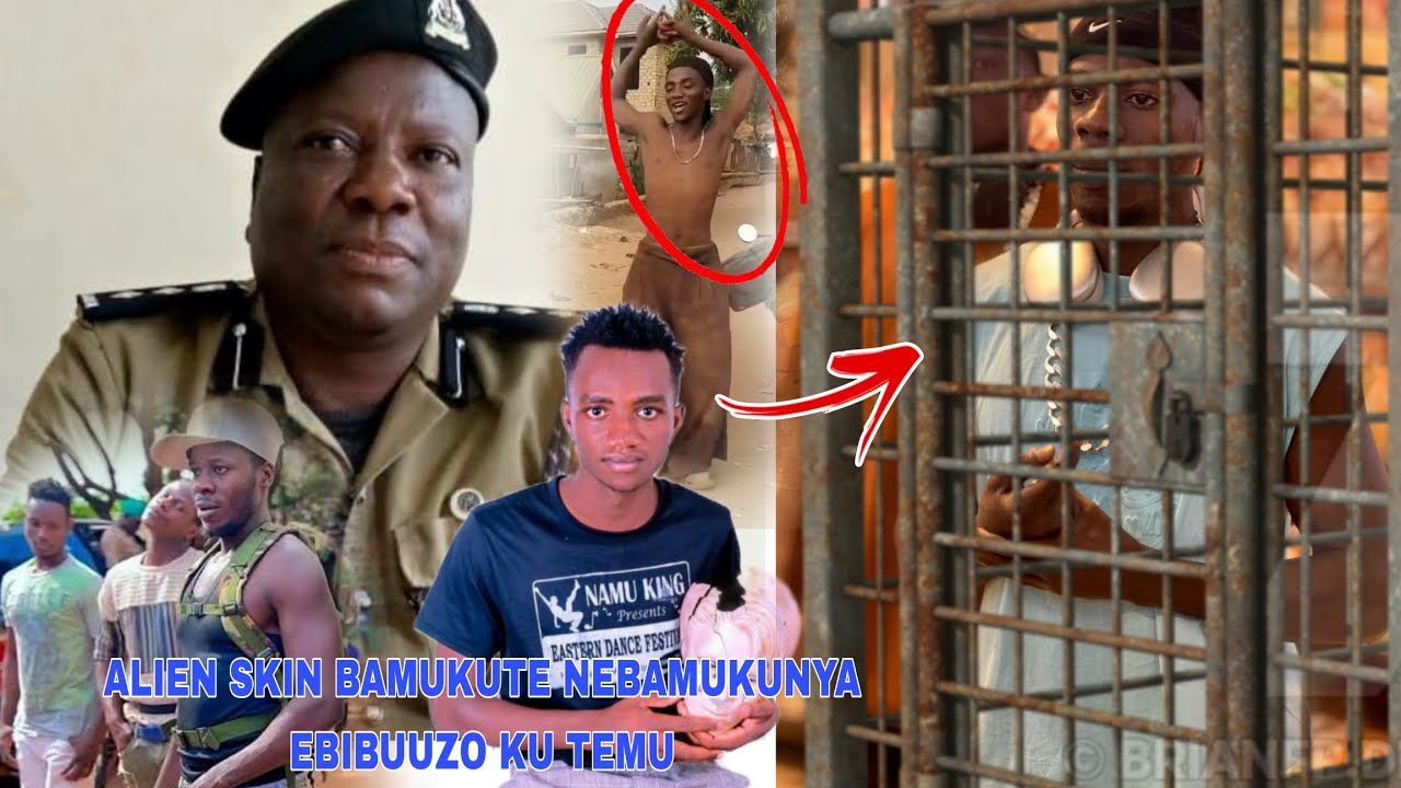 Ekiri Ku Police Webasibide Alien Skin Kyokya,Bamukute Nebamukunya Ebibuuzo Ku Nffa Ya Top Dancer