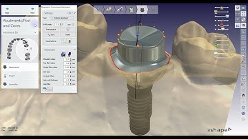 How to design a Customised Abutment in 3Shape