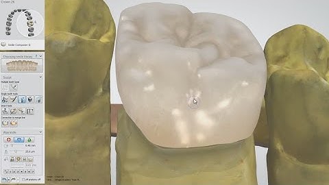 Smile Composer™ 2 0 with Integrated Sculpt Toolkit