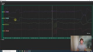 BrainAccess HALO Setup Tutorial