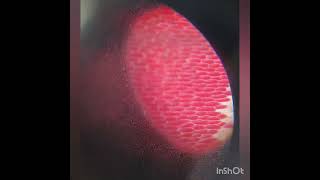 Observation of cells under the compound microscope