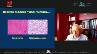 Soft tissue sarcomas:which presentations and treatment pathways should be clinically optimized, how? screenshot 4