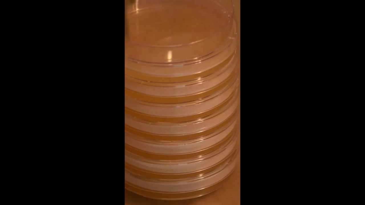 Agar series video 2 managing condensation YouTube