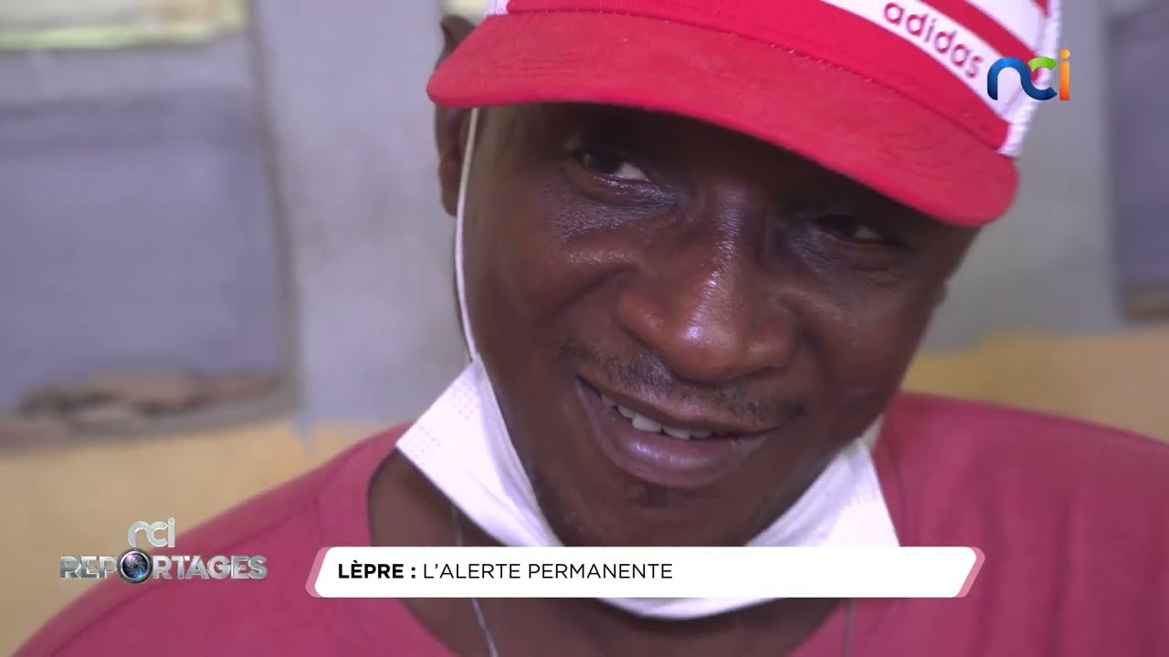 NCI REPORTAGES du 02 février 2025 | La lèpre : l’alerte permanente