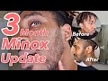 Minoxidil Beard Journey | 90 Day Results! | It Really Works! | #beardjourney #minoxidiljourney