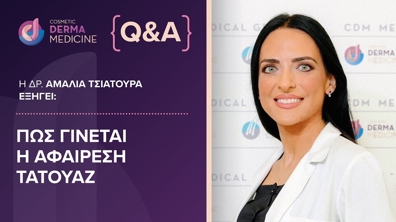 Αφαίρεση #τατουάζ με Laser (Laser Tattoo Removal) Πλήρης Οδηγός