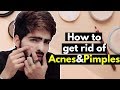How to get rid of acnes and pimples in a week