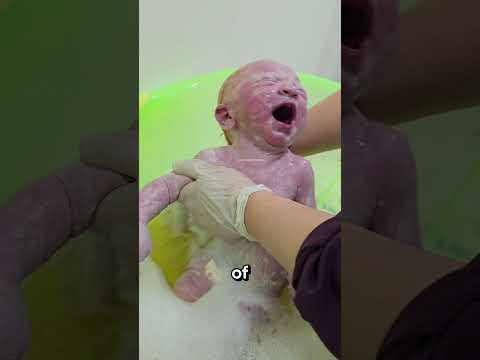 لماذا يستحم الأطباء الأطفال حديثي الولادة