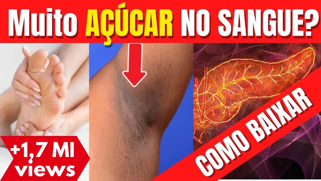 10 DICAS para BAIXAR o AÇÚCAR DO SANGUE HOJE MESMO (diabetes e pré-diabetes)