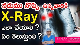 X- rays in the evaluation of low back pain I back pain x- ray I Dr GPV Subbaiah