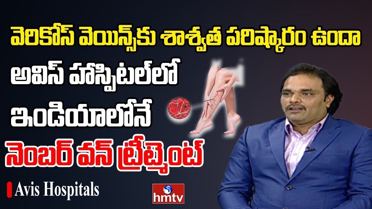 Varicose Veins & CLACS Treatment Explained by Dr. C. Avinash | Avis Hospitals