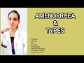 Amenorrhea gynecologyexplained with notes dr deeksha