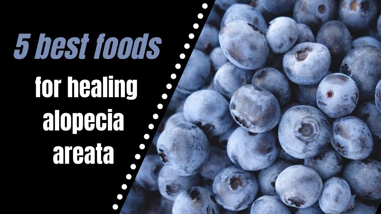 5 best foods for treating alopecia areata and regrowing hair YouTube