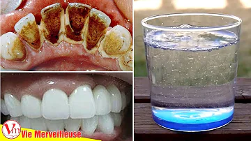 Quel est le meilleur dentifrice contre la plaque dentaire ?
