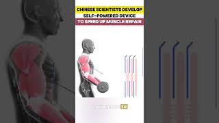 Full Chinese scientists develop self-powered device to speed up muscle repair#fyp #fypシ #china Guide