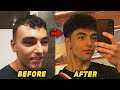 The Meat And Potatoes Hair Loss Prevention Stack - Before And After