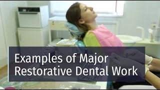 Examples of Major Restorative Dental Work screenshot 4