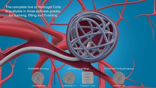 MicroVention Coil Procedural and Clinical Outcome Animation