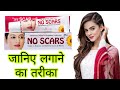 No Scars Cream की पूरी सच्चाई