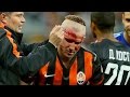 Страшная травма Кучера | Kucher's horror injury