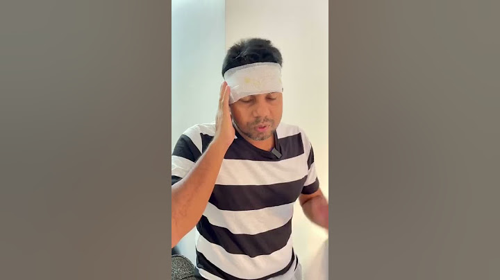 போலி Doctor 👩‍⚕️ | Rj Chandru Menaka Comedy | #shorts