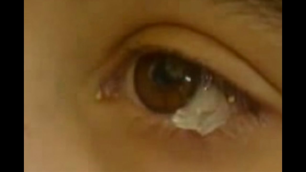 Young Girl Cries REAL CRYSTAL Tears! YouTube