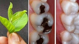 एक ही बार में दांत के कीड़े बाहर निकालकर दांत के दर्द ठीक कर देगा?,  remedy for toothache,@Health A1