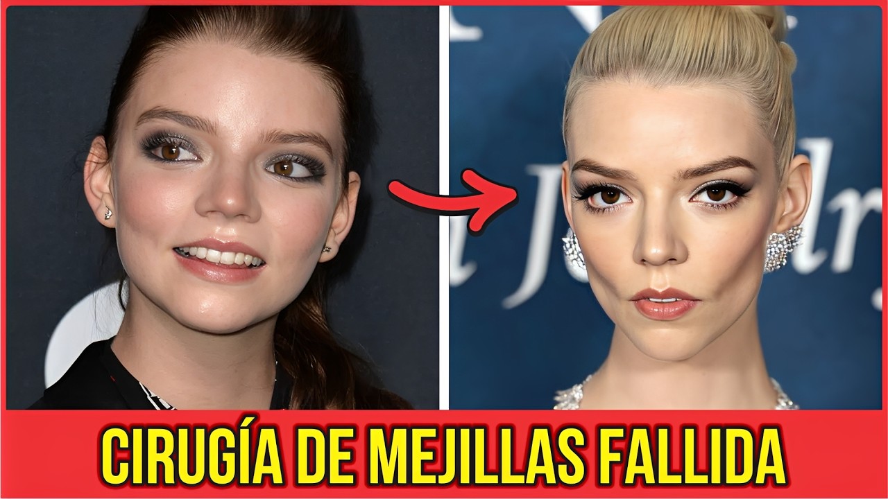 Top 10 Celebrities Who Were Left Deformed After a Buccal Fat ...