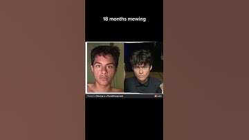 18 months mewing #shorts #mewing