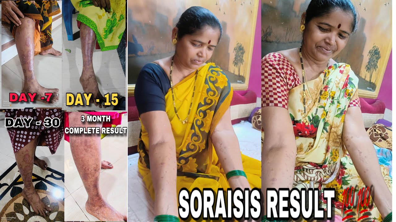 Soraisis result 💯 guerenteed mi lifestyle product| 