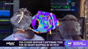 3D heart mapping AR software cleared by FDA that allows doctors to see a 3D image of the heart