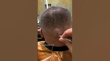 Ingrown Hairs Shorts Skincare Hair 