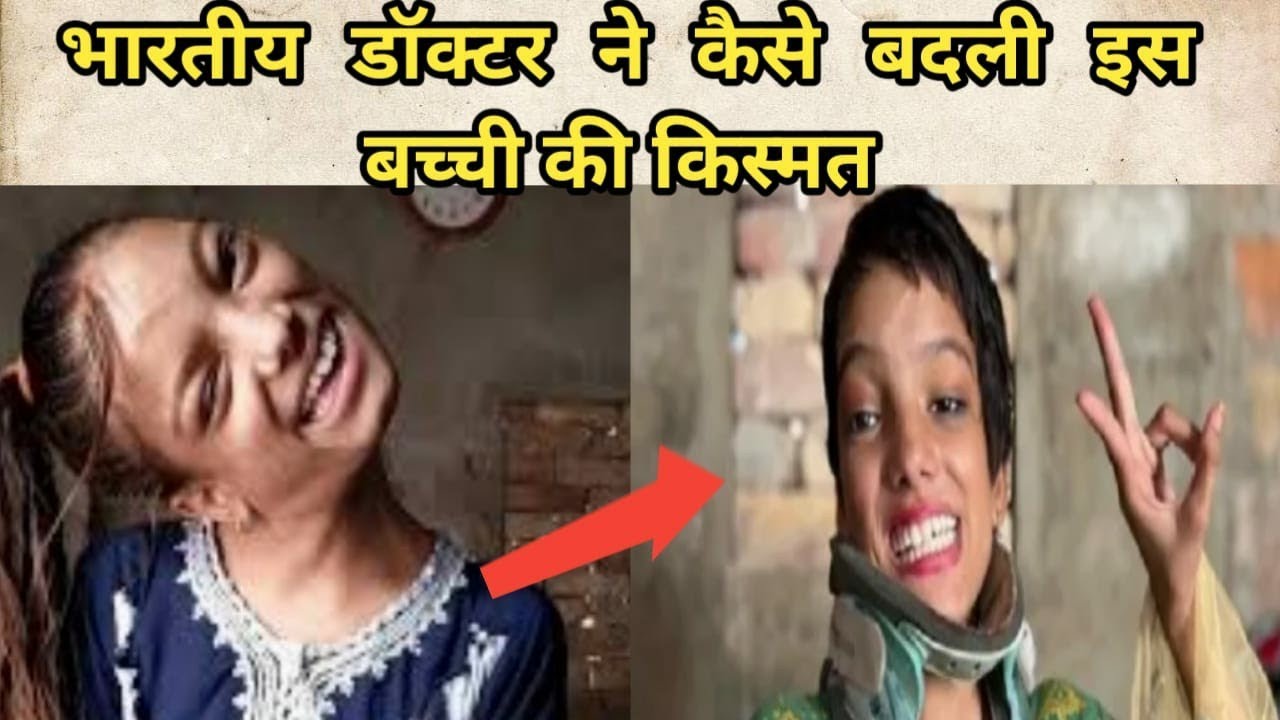 How a Pakistani girl with neck bent at 90 degrees saved by Indian doctor? YouTube