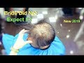 Bride Wouldn't Expect it On Her Wedding! Groom Surprised By Wife's Reaction! Dubai | Hair Fiber